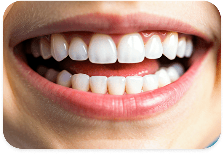 Healthy smile closeup